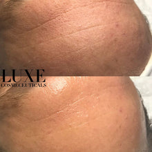 Load image into Gallery viewer, Peptide sheet mask for collagen boosting and skin repair in Australia