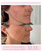 Load image into Gallery viewer, Best Seller Bundle
