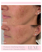 Load image into Gallery viewer, Best Seller Bundle
