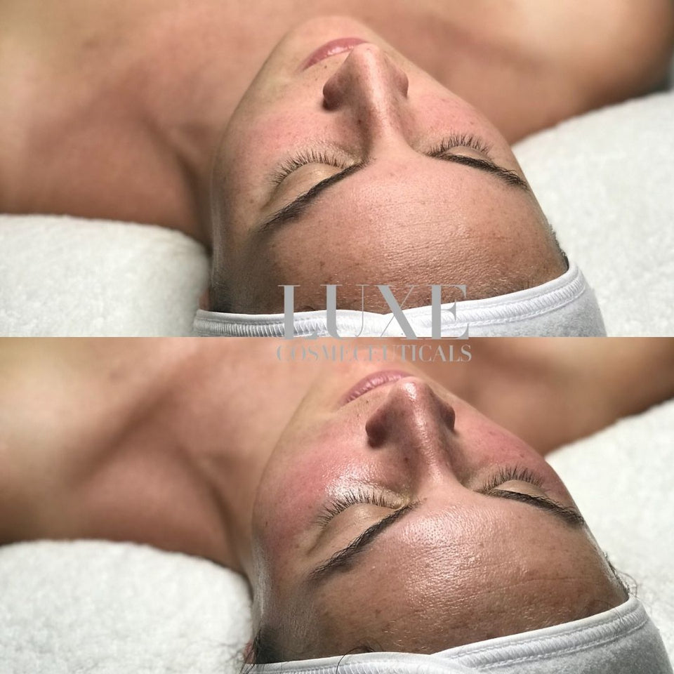 Natural skincare near Canberra Civic